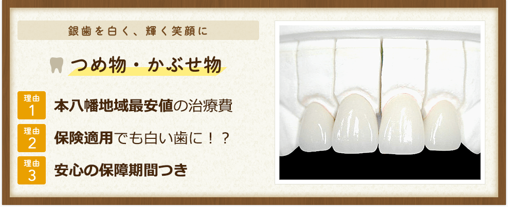 銀歯を白く、輝く笑顔に